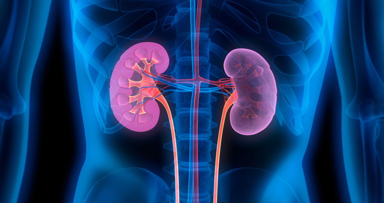 Kidney X-ray image
