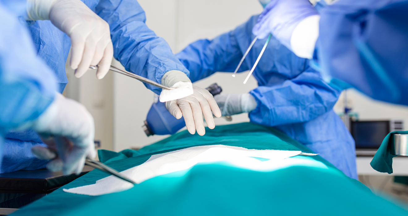 Surgical gastro procedure